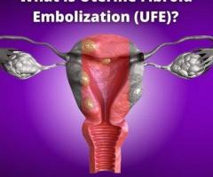 Choosing Treatment: Myomectomy vs. UFE - Find Relief at USA Fibroid Centers!