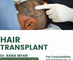 Hair transplant in Pakistan