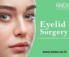 Eyelid Surgery In Banashankari, Bangalore – Anew