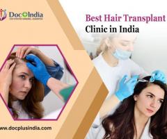 Top Hair Transplant Clinic in India - Doc Plus India