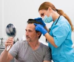 Scalp Micropigmentation in Kochi: Advanced Solution for Hair Loss Concealment