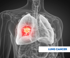 How EdhaCare Selects Cancer Hospitals