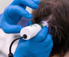 Hair Restoration in Ernakulam – Advanced Treatments for Healthy Hair Growth