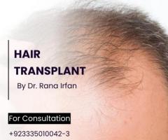 Hair restoration services in islamabad Pakistan