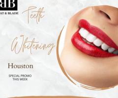 How to Find The Best Teeth Whitening Service in Houston?
