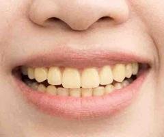 Top Dental Oral Care Treatments in Peelamedu,Coimbatore