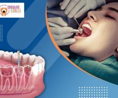 Best dental clinic in Whitefield -  Growing Smiles