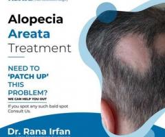 Hair transplant services in Pakistan