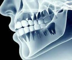 Dental X-Ray in Pune | Orthopantamogram (OPG) Near me | Pathak Dental Clinic