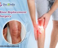 knee Replacement Surgery in Bangalore: Docplus India - 1