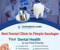 Dental Implants in Pimple Saudagar | Star Dental Clinic