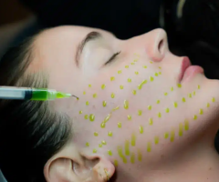 Med Spa in Fort Worth TX | Skin & Wellness Treatments