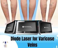 Advanced Diode Laser for Varicose Veins