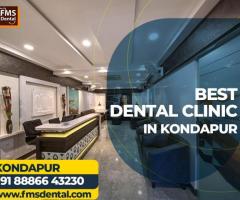 Best Dental Clinic in Kondapur Call Now : 08886643230