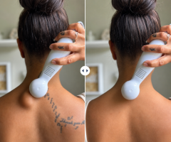 What Are the Most Popular Ways to Get Rid of Lipoma Naturally?