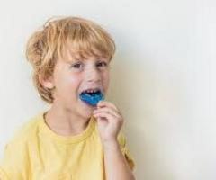 Mouth Guard Services in Oakville
