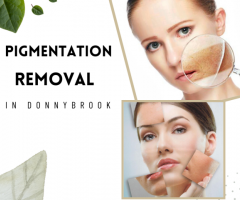 Best Pigmentation Removal Services in Donnybrook