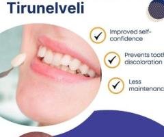Cosmetic Veneers Tirunelveli