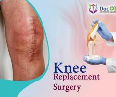 Knee Replacement Surgery In Bangalore At Docplus India