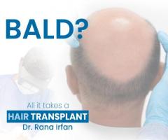Hair Transplant Service by Dr Rana Irfan in Islamabad