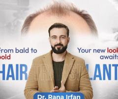 Hair Transplant Service by Dr Rana Irfan in Islamabad, Pakistan