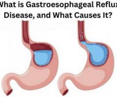 What causes gastroesophageal reflux disease?