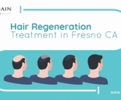 Hair Regeneration Treatment in Fresno CA - 1