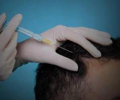 Best Hair Clinic in Kochi: Expert Care for Hair and Scalp Concerns
