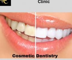 Cosmetic Dentistry in Mogappair