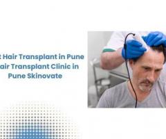 Best Hair Transplant in Pune | Hair Transplant Clinic in Pune Skinovate