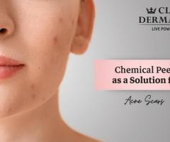 Chemical Peels as a Solution for Acne Scars at Clinic Dermatech