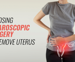Laparoscopic Surgery to Remove Uterus | Worldofurology