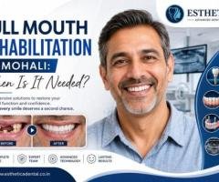 Find Reliable Dental Implants Clinics in Mohali
