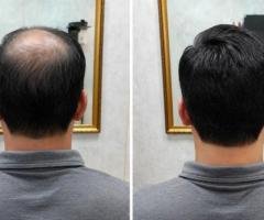 Olaplex Hair Treatment Price – Professional Hair Care