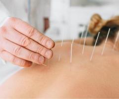 Get Pain Relief by Dry Needling - Best Massage Melbourne CBD