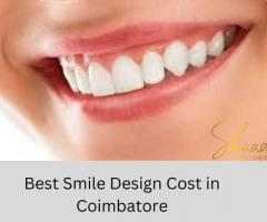 Smile Design Cost in Coimbatore
