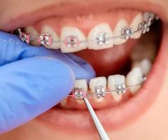 Best Orthodontist Treatment in Pune | Orthodontics Treatment in Shivaji Nagar
