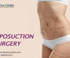 Liposuction Surgery In Hyderabad At Docplus India
