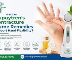 How Can Dupuytren’s Contracture Home Remedies Support Hand Flexibility?